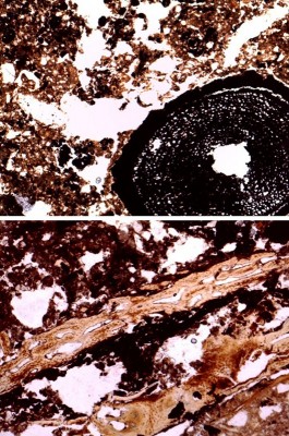 Figure 5. Micrographs showing wood fragments (above), burnt bone fragments and peat residues (below).